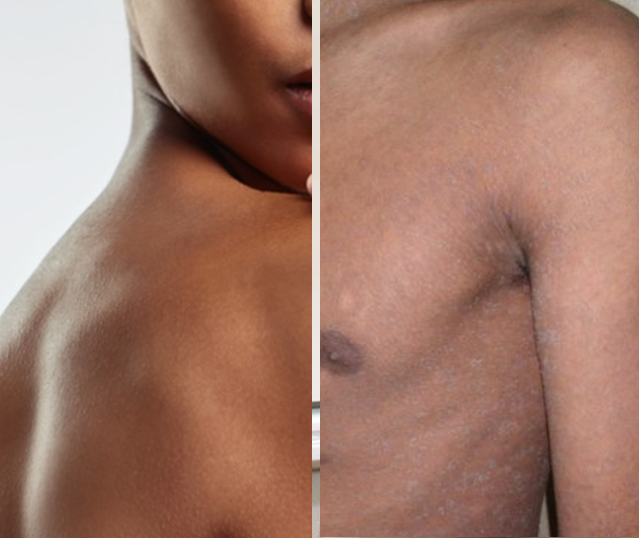 Specialite_dermatologie